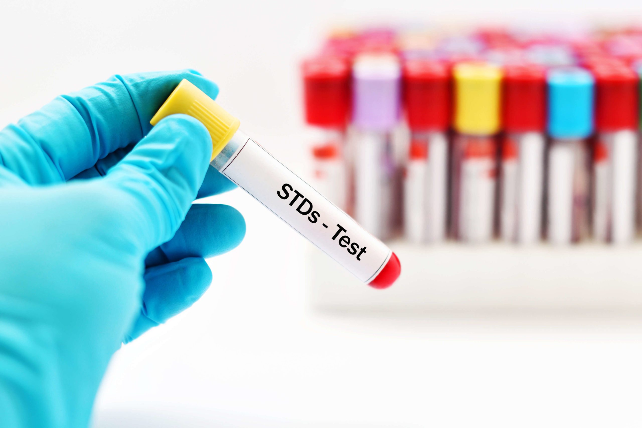 List of the Most Common STDs